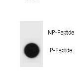 Hamartin / TSC1 Antibody - Dot blot of mouse TSC1 Antibody (Phospho S591) Phospho-specific antibody on nitrocellulose membrane. 50ng of Phospho-peptide or Non Phospho-peptide per dot were adsorbed. Antibody working concentrations are 0.6ug per ml.