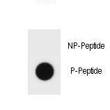 Hamartin / TSC1 Antibody - Dot blot of TSC1 Antibody (Phospho S598) Phospho-specific antibody on nitrocellulose membrane. 50ng of Phospho-peptide or Non Phospho-peptide per dot were adsorbed. Antibody working concentrations are 0.6ug per ml.