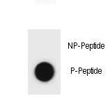 Hamartin / TSC1 Antibody - Dot blot of TSC1 Antibody (Phospho S682) Phospho-specific antibody on nitrocellulose membrane. 50ng of Phospho-peptide or Non Phospho-peptide per dot were adsorbed. Antibody working concentrations are 0.6ug per ml.