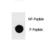 Hamartin / TSC1 Antibody - Dot blot of rat TSC1 Antibody (Phospho T417) Phospho-specific antibody on nitrocellulose membrane. 50ng of Phospho-peptide or Non Phospho-peptide per dot were adsorbed. Antibody working concentrations are 0.6ug per ml.