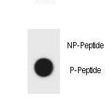 Hamartin / TSC1 Antibody - Dot blot of mouse TSC1 Antibody (Phospho Y304) Phospho-specific antibody on nitrocellulose membrane. 50ng of Phospho-peptide or Non Phospho-peptide per dot were adsorbed. Antibody working concentrations are 0.6ug per ml.