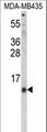 HAMP / Hepcidin Antibody - Western blot of HAMP Antibody in MDA-MB435 cell line lysates (35 ug/lane). HAMP (arrow) was detected using the purified antibody.