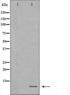 HAMP / Hepcidin Antibody - Western blot analysis of extracts of MB435 using HAMP antibody. The lane on the left is treated with the antigen-specific peptide.