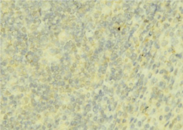 HAMP / Hepcidin Antibody - 1:100 staining mouse liver tissue by IHC-P. The sample was formaldehyde fixed and a heat mediated antigen retrieval step in citrate buffer was performed. The sample was then blocked and incubated with the antibody for 1.5 hours at 22°C. An HRP conjugated goat anti-rabbit antibody was used as the secondary.
