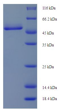CTSD / Cathepsin D Protein