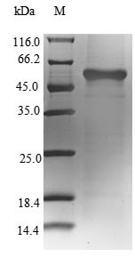 GLUL / Glutamine Synthetase Protein - (Tris-Glycine gel) Discontinuous SDS-PAGE (reduced) with 5% enrichment gel and 15% separation gel.