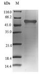 GLUL / Glutamine Synthetase Protein - (Tris-Glycine gel) Discontinuous SDS-PAGE (reduced) with 5% enrichment gel and 15% separation gel.