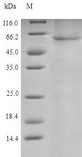 PDI / P4HB Protein - (Tris-Glycine gel) Discontinuous SDS-PAGE (reduced) with 5% enrichment gel and 15% separation gel.