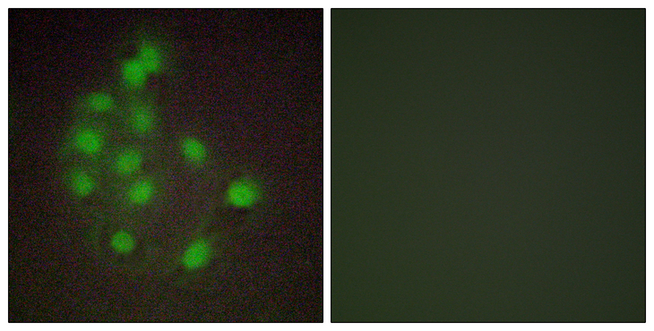 HAND1 Antibody - Immunofluorescence analysis of A549 cells, using HAND1 Antibody. The picture on the right is blocked with the synthesized peptide.