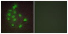 HAND1 Antibody - Immunofluorescence analysis of A549 cells, using HAND1 Antibody. The picture on the right is blocked with the synthesized peptide.