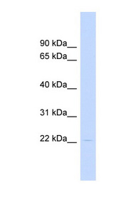 HAND1 Antibody - HAND1 antibody Western blot of Fetal liver lysate. This image was taken for the unconjugated form of this product. Other forms have not been tested.