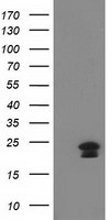 HAND1 Antibody - HEK293T cells were transfected with the pCMV6-ENTRY control (Left lane) or pCMV6-ENTRY HAND1 (Right lane) cDNA for 48 hrs and lysed. Equivalent amounts of cell lysates (5 ug per lane) were separated by SDS-PAGE and immunoblotted with anti-HAND1.