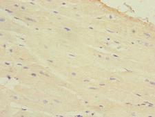 HAND1 Antibody - Immunohistochemistry of paraffin-embedded human heart tissue at dilution 1:100