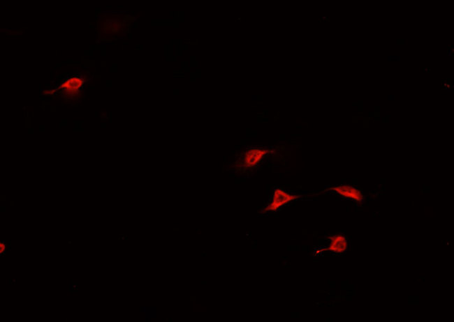 HAND1 Antibody - Staining U-2 OS cells by IF/ICC. The samples were fixed with PFA and permeabilized in 0.1% Triton X-100, then blocked in 10% serum for 45 min at 25°C. The primary antibody was diluted at 1:200 and incubated with the sample for 1 hour at 37°C. An Alexa Fluor 594 conjugated goat anti-rabbit IgG (H+L) antibody, diluted at 1/600, was used as secondary antibody.