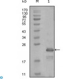 HAND1 Antibody - Western Blot (WB) analysis using HAND1 Monoclonal Antibody against truncated Trx-HAND1 recombinant protein (1).