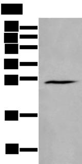 HAND1 Antibody - Western blot analysis of Human fetal brain tissue lysate  using HAND1 Polyclonal Antibody at dilution of 1:400