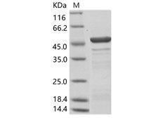 Hantaan Virus Nucleocapsid Protein - Recombinant Hantaan virus HTNV (strain 84FLi) Nucleocapsid / NP Protein (His Tag)