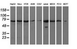 HAO1 Antibody - Western blot analysis of extracts (35ug) from 9 different cell lines by using anti-HAO1 monoclonal antibody.