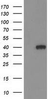 HAO1 Antibody - HEK293T cells were transfected with the pCMV6-ENTRY control (Left lane) or pCMV6-ENTRY HAO1 (Right lane) cDNA for 48 hrs and lysed. Equivalent amounts of cell lysates (5 ug per lane) were separated by SDS-PAGE and immunoblotted with anti-HAO1.