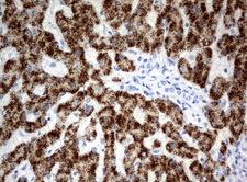 HAO1 Antibody - Immunohistochemical staining of paraffin-embedded Human liver tissue using anti-HAO1 mouse monoclonal antibody.  heat-induced epitope retrieval by 10mM citric buffer, pH6.0, 120C for 3min)