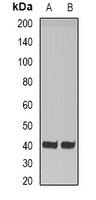 HAO1 Antibody - Western blot analysis of HAO1 expression in mouse liver (A); rat liver (B) whole cell lysates.