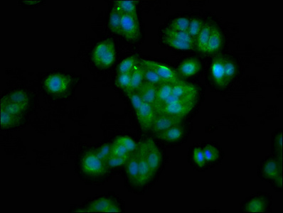 HAO1 Antibody - Immunofluorescence staining of HepG2 cells at a dilution of 1:100, counter-stained with DAPI. The cells were fixed in 4% formaldehyde, permeabilized using 0.2% Triton X-100 and blocked in 10% normal Goat Serum. The cells were then incubated with the antibody overnight at 4 °C.The secondary antibody was Alexa Fluor 488-congugated AffiniPure Goat Anti-Rabbit IgG (H+L) .