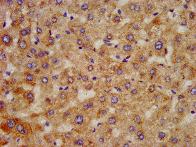 HAO1 Antibody - Immunohistochemistry image at a dilution of 1:300 and staining in paraffin-embedded human liver tissue performed on a Leica BondTM system. After dewaxing and hydration, antigen retrieval was mediated by high pressure in a citrate buffer (pH 6.0) . Section was blocked with 10% normal goat serum 30min at RT. Then primary antibody (1% BSA) was incubated at 4 °C overnight. The primary is detected by a biotinylated secondary antibody and visualized using an HRP conjugated SP system.