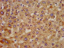 HAO1 Antibody - Immunohistochemistry image at a dilution of 1:300 and staining in paraffin-embedded human liver tissue performed on a Leica BondTM system. After dewaxing and hydration, antigen retrieval was mediated by high pressure in a citrate buffer (pH 6.0) . Section was blocked with 10% normal goat serum 30min at RT. Then primary antibody (1% BSA) was incubated at 4 °C overnight. The primary is detected by a biotinylated secondary antibody and visualized using an HRP conjugated SP system.