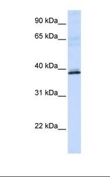 HAO2 Antibody - MCF7 cell lysate. Antibody concentration: 1.0 ug/ml. Gel concentration: 12%.  This image was taken for the unconjugated form of this product. Other forms have not been tested.