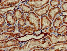 HAO2 Antibody - Immunohistochemistry of paraffin-embedded human kidney tissue at dilution of 1:100