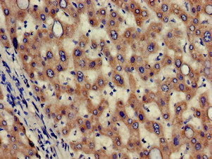 HAO2 Antibody - Immunohistochemistry of paraffin-embedded human liver tissue at dilution of 1:100