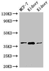 HAO2 Antibody - Western Blot Positive WB detected in:MCF-7 whole cell lysate,Rat kidney tissue,Mouse kidney tissue All Lanes:HAO2 antibody at 3µg/ml Secondary Goat polyclonal to rabbit IgG at 1/50000 dilution Predicted band size: 39,41 KDa Observed band size: 39 KDa
