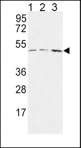HAPLN1 Antibody - HAPLN1 Antibody western blot of MCF-7(lane 1),Jurkat(lane 2),HepG2(lane 3) cell line lysates (35 ug/lane). The HAPLN1 antibody detected the HAPLN1 protein (arrow).