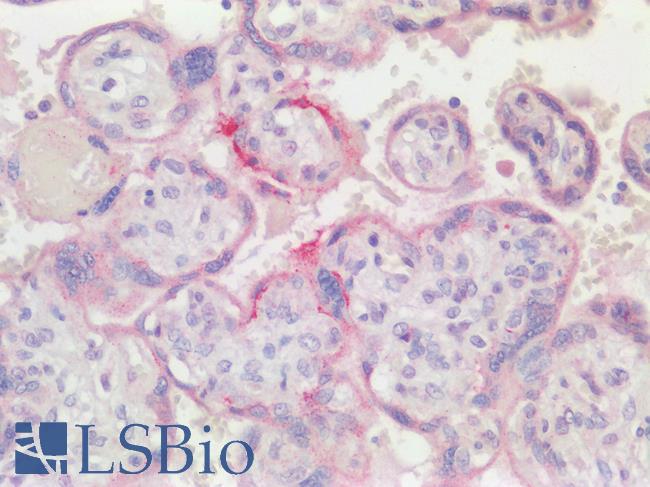 HAPLN1 Antibody - Human Placenta, Trophoblasts: Formalin-Fixed, Paraffin-Embedded (FFPE)