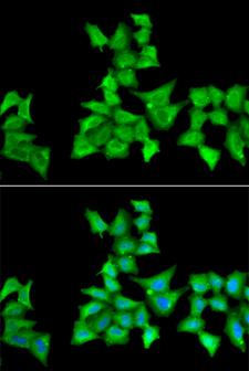 HAPLN1 Antibody - Immunofluorescence analysis of A549 cells.