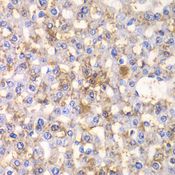 HAPLN1 Antibody - Immunohistochemistry of paraffin-embedded rat liver using HAPLN1 antibody at dilution of 1:100 (40x lens).