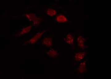 HAPLN1 Antibody - Staining HepG2 cells by IF/ICC. The samples were fixed with PFA and permeabilized in 0.1% Triton X-100, then blocked in 10% serum for 45 min at 25°C. The primary antibody was diluted at 1:200 and incubated with the sample for 1 hour at 37°C. An Alexa Fluor 594 conjugated goat anti-rabbit IgG (H+L) Ab, diluted at 1/600, was used as the secondary antibody.