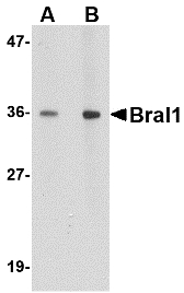 HAPLN2 Antibody - Western blot of BRAL1 in human brain tissue lysate with BRAL1 antibody at (A) 1 and (B) 2 ug/ml.