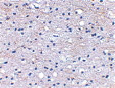 HAPLN2 Antibody - Immunohistochemical staining of human brain tissue using BRAL1 antibody at 2.5 ug/ml.