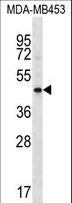 HAPLN3 Antibody - HAPLN3 Antibody western blot of MDA-MB453 cell line lysates (35 ug/lane). The HAPLN3 antibody detected the HAPLN3 protein (arrow).