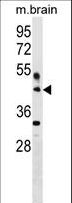 HAPLN4 Antibody - HAPLN4 Antibody western blot of mouse brain tissue lysates (35 ug/lane). The HAPLN4 antibody detected the HAPLN4 protein (arrow).