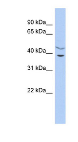 HARBI1 Antibody - HARBI1 / C11orf77 antibody Western blot of THP-1 cell lysate. This image was taken for the unconjugated form of this product. Other forms have not been tested.