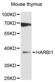 HARBI1 Antibody - Western blot analysis of extracts of mouse thymus, using HARBI1 antibody at 1:3000 dilution. The secondary antibody used was an HRP Goat Anti-Rabbit IgG (H+L) at 1:10000 dilution. Lysates were loaded 25ug per lane and 3% nonfat dry milk in TBST was used for blocking. An ECL Kit was used for detection and the exposure time was 60s.