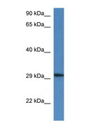 HARBI1 Antibody - HARBI1 / C11orf77 antibody Western blot of Mouse Kidney lysate. Antibody concentration 1 ug/ml. This image was taken for the unconjugated form of this product. Other forms have not been tested.