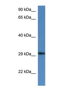 HARBI1 Antibody - HARBI1 / C11orf77 antibody Western blot of Mouse Kidney lysate. Antibody concentration 1 ug/ml. This image was taken for the unconjugated form of this product. Other forms have not been tested.