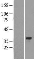 HARBI1 Protein - Western validation with an anti-DDK antibody * L: Control HEK293 lysate R: Over-expression lysate