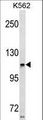 Harmonin / USH1C Antibody - USH1C Antibody western blot of K562 cell line lysates (35 ug/lane). The USH1C antibody detected the USH1C protein (arrow).
