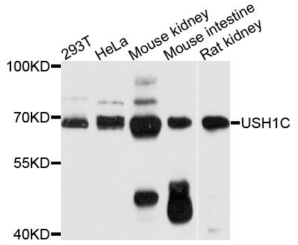 Harmonin / USH1C Antibody - Western blot analysis of extracts of various cell lines, using USH1C antibody at 1:1000 dilution. The secondary antibody used was an HRP Goat Anti-Rabbit IgG (H+L) at 1:10000 dilution. Lysates were loaded 25ug per lane and 3% nonfat dry milk in TBST was used for blocking. An ECL Kit was used for detection and the exposure time was 30s.