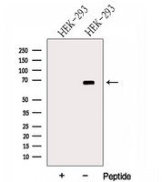 Harmonin / USH1C Antibody - Western blot analysis of extracts of HEK293 cells using Harmonin antibody. The lane on the left was treated with blocking peptide.