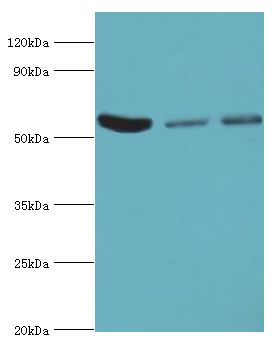 HARS Antibody - Western blot. All lanes: Histidine--tRNA ligase, cytoplasmic antibody at 6 ug/ml. Lane 1: HeLa whole cell lysate. Lane 2: K562 whole cell lysate. Lane 3: 293T whole cell lysate. secondary Goat polyclonal to rabbit at 1:10000 dilution. Predicted band size: 57 kDa. Observed band size: 57 kDa.